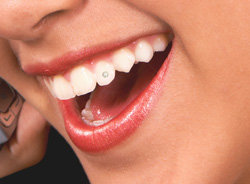 Cosmetic Custom Made Tooth Jewellery